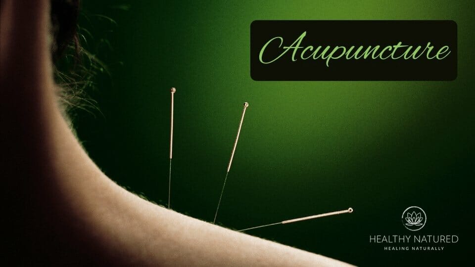 acupuncture acupuncture