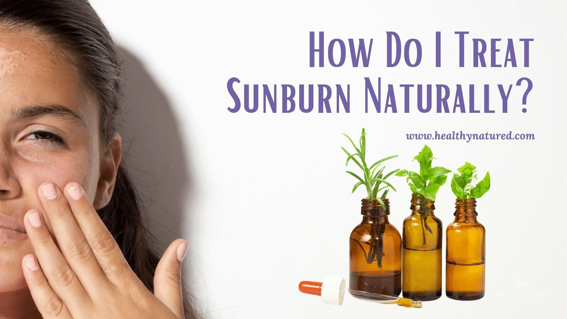 how do i treat sunburn naturally