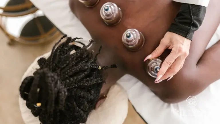Acupuncture Cupping Therapy - Cups Being placed