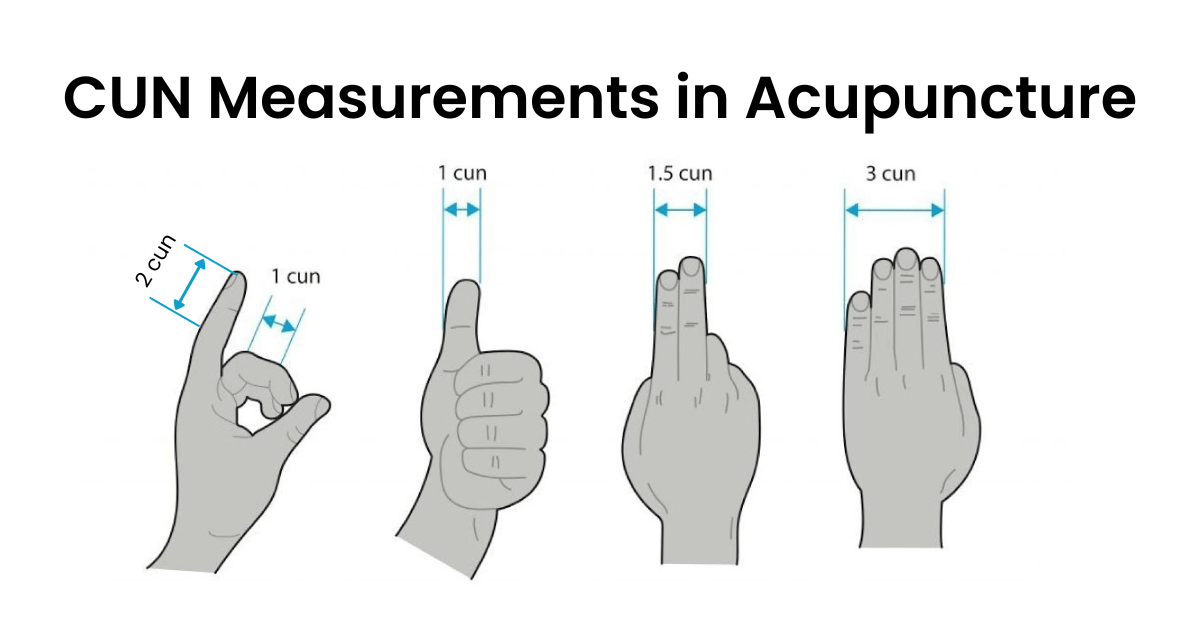 CUN Measurements in Acupuncture